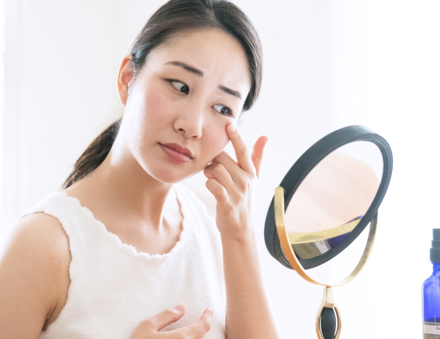 目の下のクマで悩んでいる女性