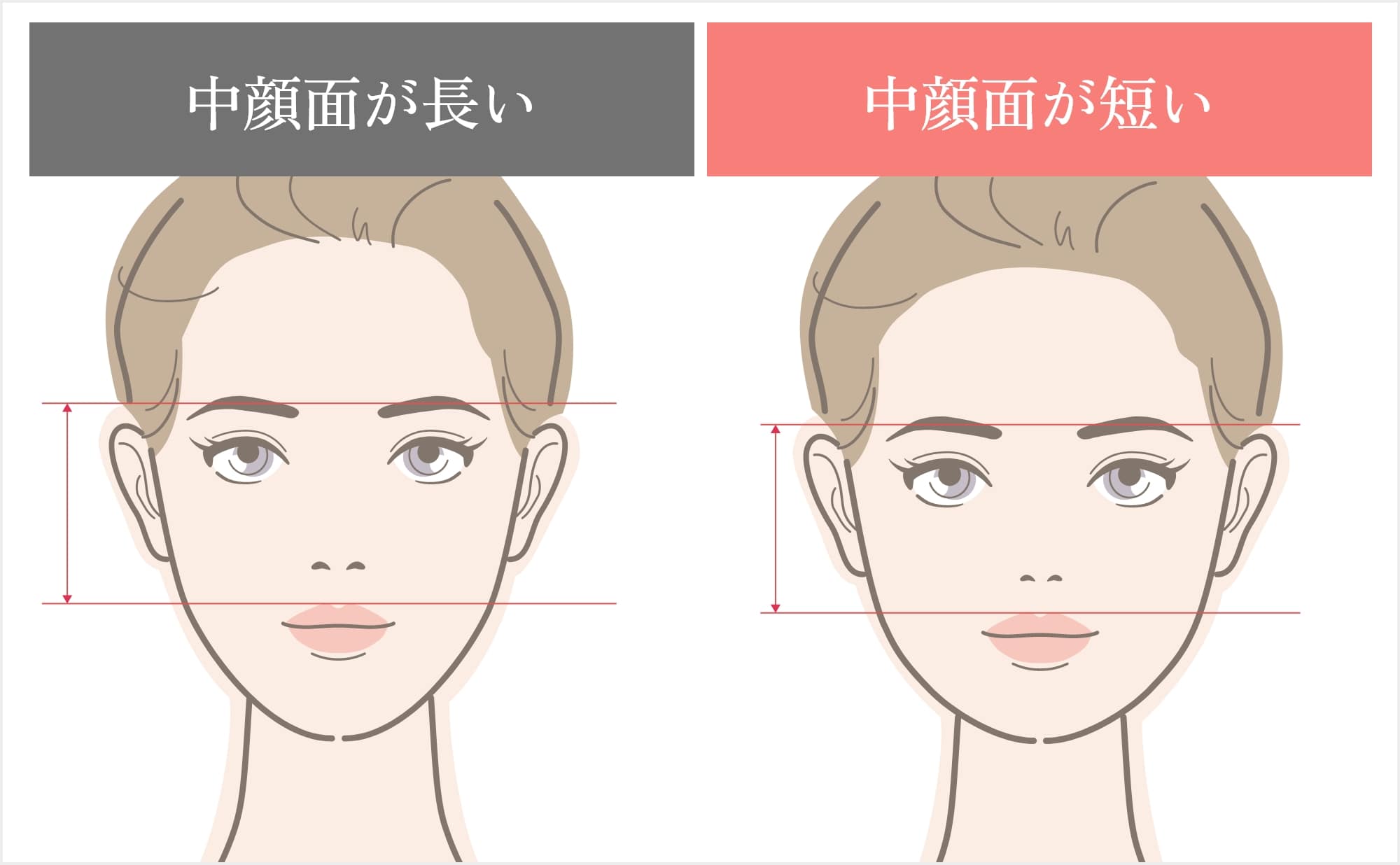 中顔面の長さの違い