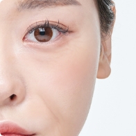 しわ・たるみ治療