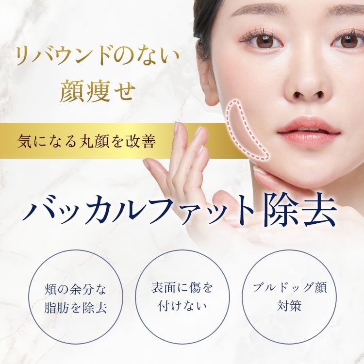 バッカルファット除去-mv-sp