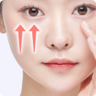 中顔面バーティカルリフト