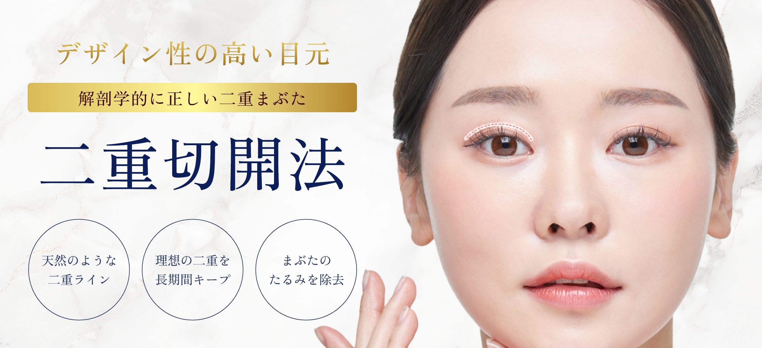 二重切開法-一覧