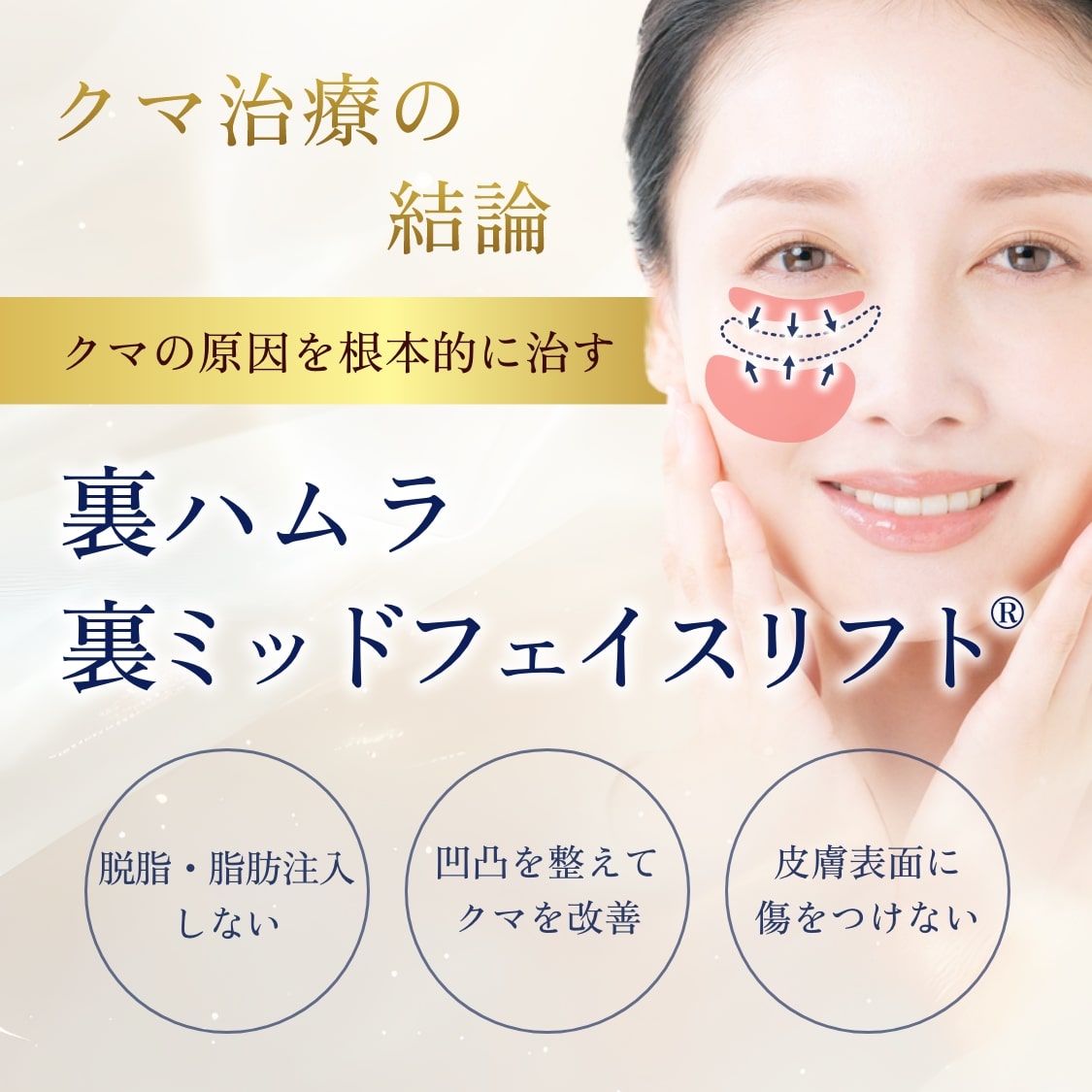 裏ハムラ裏ミッドフェイスリフト-mv-sp