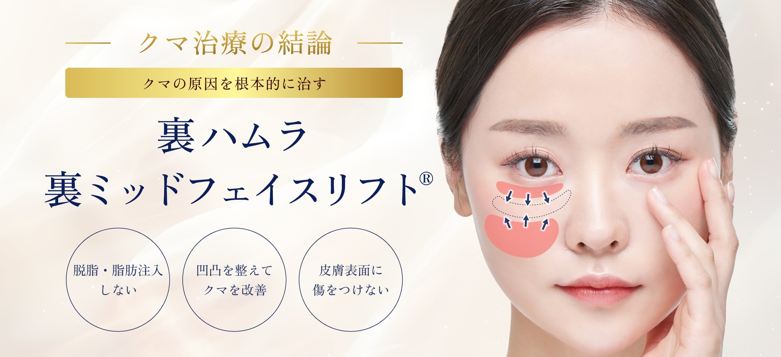 裏ハムラ裏ミッドフェイスリフト®-一覧