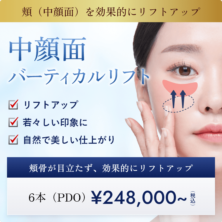 中顔面バーティカルリフト