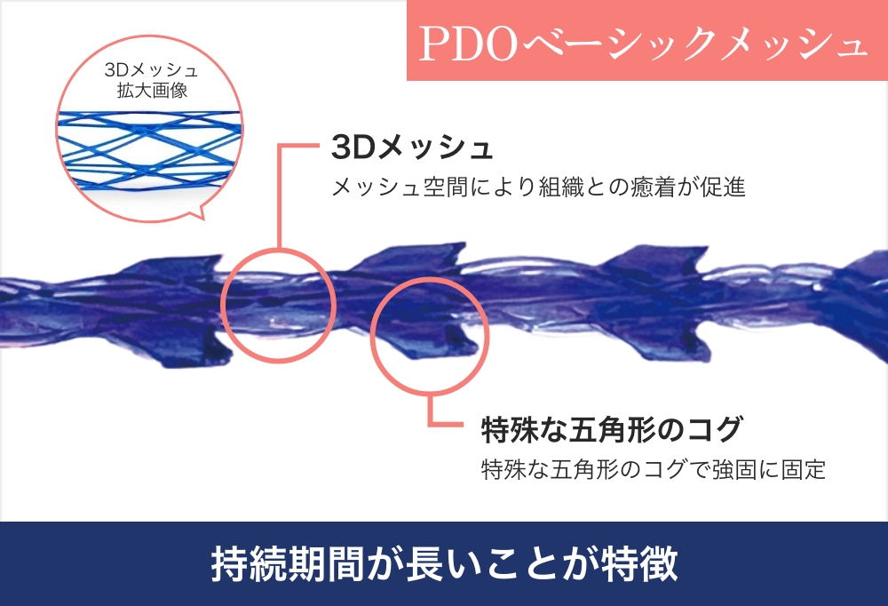 PDOベーシックメッシュの特徴の説明