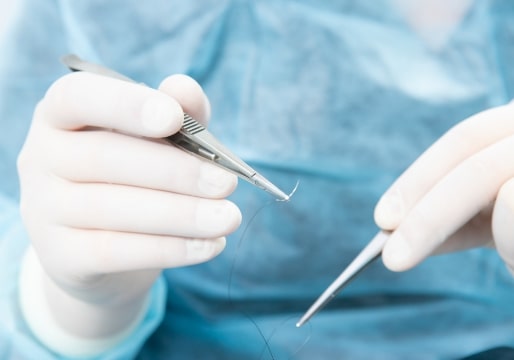 施術の流れ 縫合