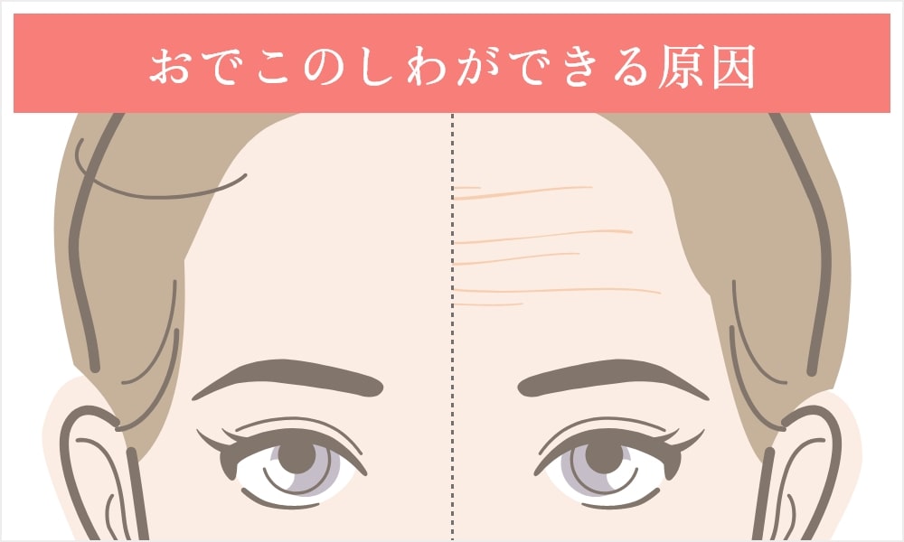 おでこのしわができる原因