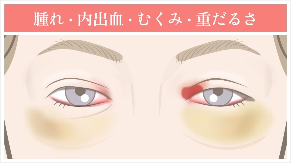 腫れ・内出血・痛み