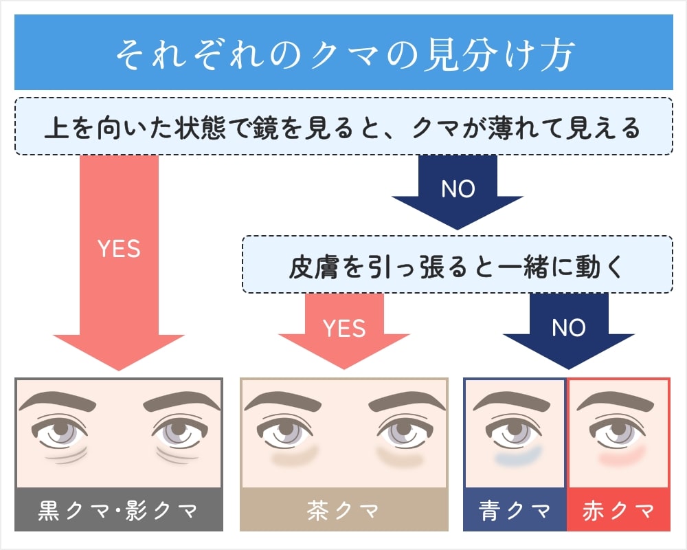クマの4タイプと見分け方