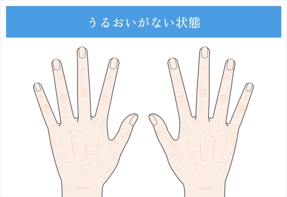 シワ・ハリ不足タイプ