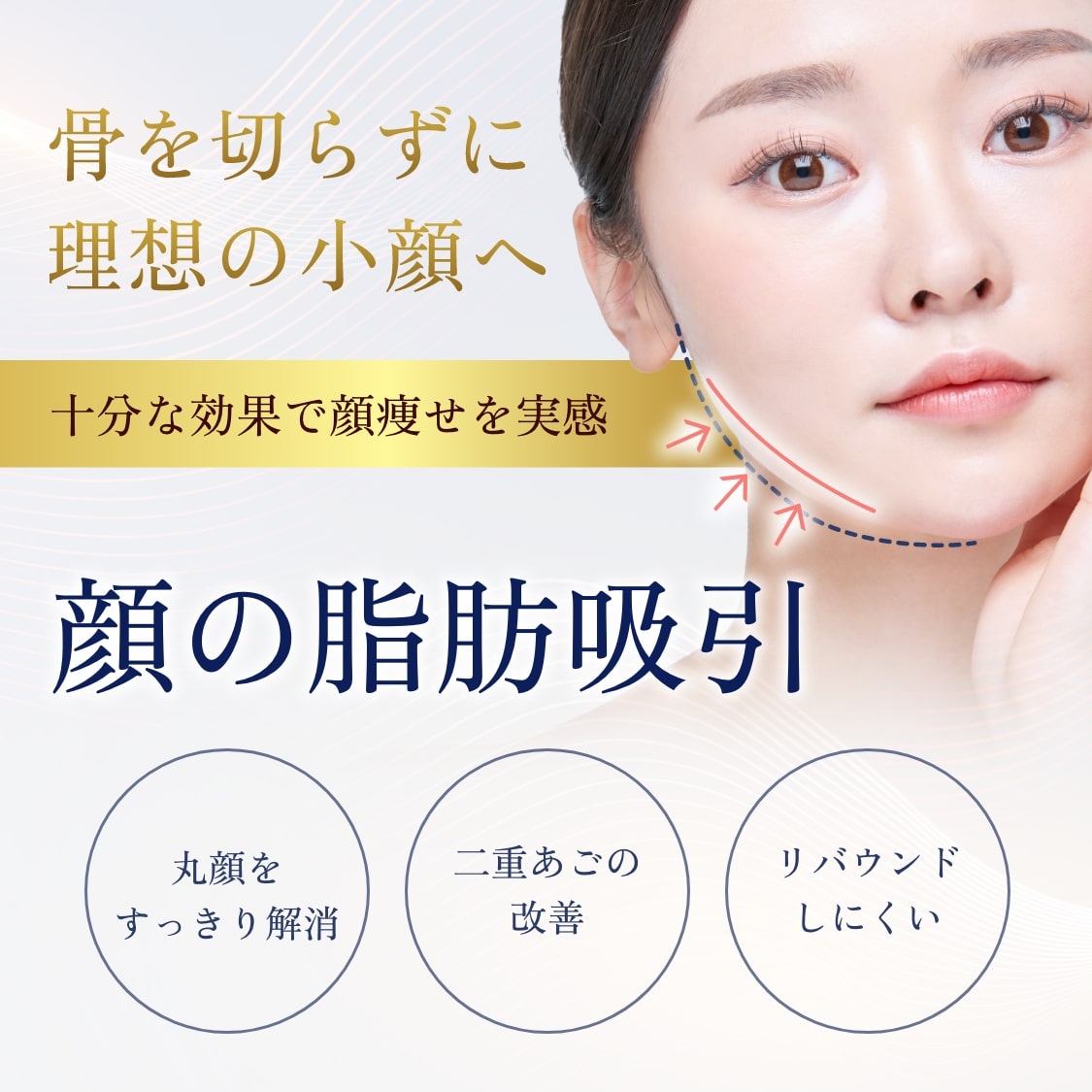 顔の脂肪吸引-mv-sp