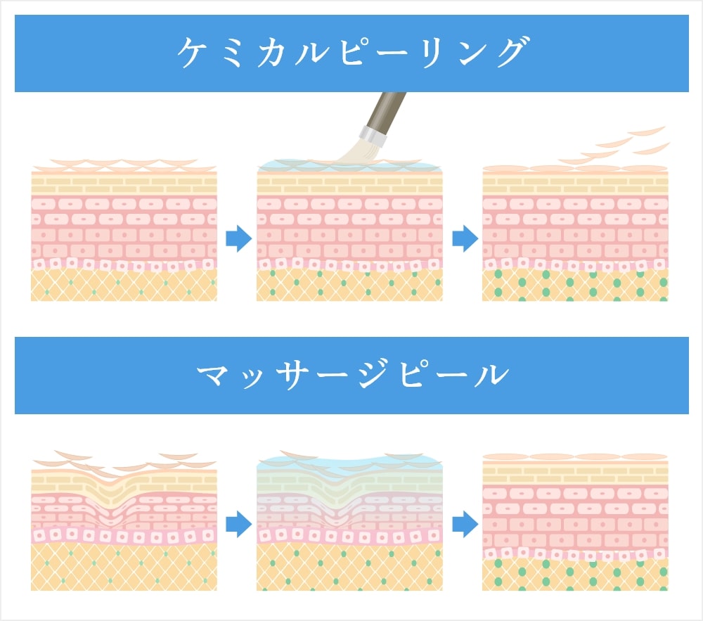 マッサージピールの仕組み